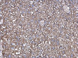 Invitrogen Factor XIII A Polyclonal Antibody 100 &mu;L; Unconjugated:Antikörper