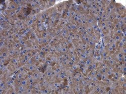 Invitrogen Factor XIII A Polyclonal Antibody 100 &mu;L; Unconjugated:Antikörper