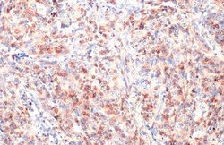Invitrogen CD74 Polyclonal Antibody 100 &mu;L; Unconjugated:Antibodies,