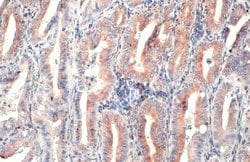 Invitrogen CD74 Polyclonal Antibody 100 &mu;L; Unconjugated:Antibodies,