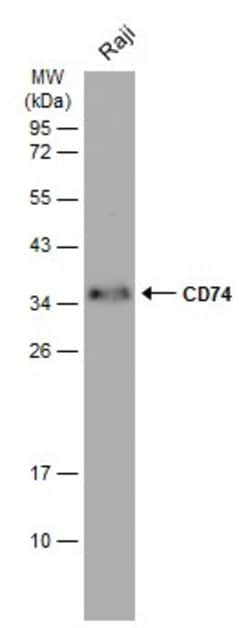Invitrogen CD74 Polyclonal Antibody 100 &mu;L; Unconjugated:Antibodies,