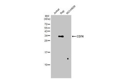 Invitrogen CD74 Polyclonal Antibody 100 &mu;L; Unconjugated:Antibodies,