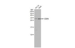Invitrogen CD74 Polyclonal Antibody 100 &mu;L; Unconjugated:Antibodies,