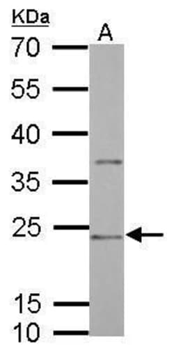 Invitrogen CD74 Polyclonal Antibody 100 &mu;L; Unconjugated:Antibodies,
