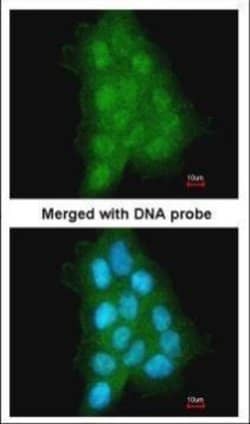 Invitrogen MAGEA11 Polyclonal Antibody 100 &mu;L; Unconjugated:Antibodies,