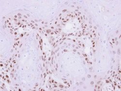 Invitrogen MAGEA11 Polyclonal Antibody 100 &mu;L; Unconjugated:Antibodies,