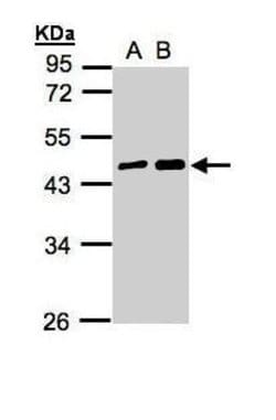 Invitrogen MAGEA11 Polyclonal Antibody 100 &mu;L; Unconjugated:Antibodies,