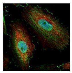 Invitrogen BIVM Polyclonal Antibody 100 &mu;L; Unconjugated:Antibodies,