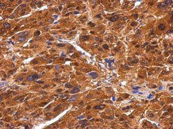 Invitrogen BIVM Polyclonal Antibody 100 &mu;L; Unconjugated:Antibodies,