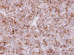 Invitrogen KIDINS220 Polyclonal Antibody 100 &mu;L; Unconjugated:Antibodies,