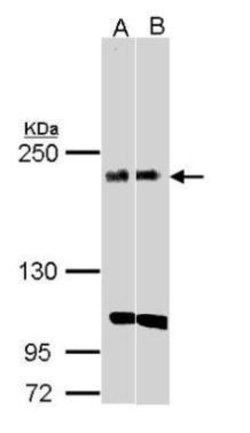 Invitrogen KIDINS220 Polyclonal Antibody 100 &mu;L; Unconjugated:Antibodies,