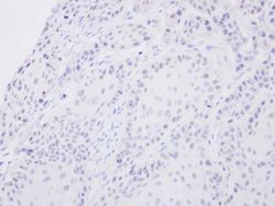 Invitrogen SENP2 Polyclonal Antibody 100 μL; Unconjugated:Antibodies,
