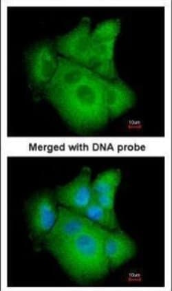 Invitrogen&trade;&nbsp;PSAT1 Polyclonal Antibody