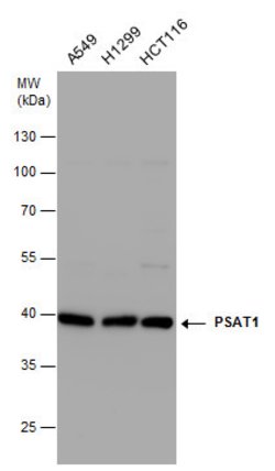 Invitrogen PSAT1 Polyclonal Antibody 100 &mu;L | Buy Online | Invitrogen&trade; | Fisher Scientific