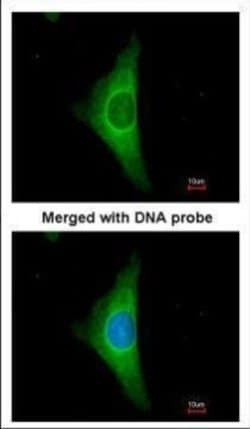 Invitrogen Cytokeratin 20 Polyclonal Antibody 100 &mu;L; Unconjugated:Antibodies,