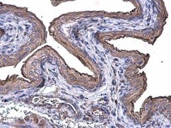 Invitrogen Cytokeratin 20 Polyclonal Antibody 100 &mu;L; Unconjugated:Antibodies,