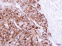 Invitrogen Cytokeratin 20 Polyclonal Antibody 100 &mu;L; Unconjugated:Antibodies,