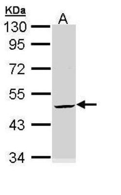 Invitrogen Cytokeratin 20 Polyclonal Antibody 100 &mu;L; Unconjugated:Antibodies,