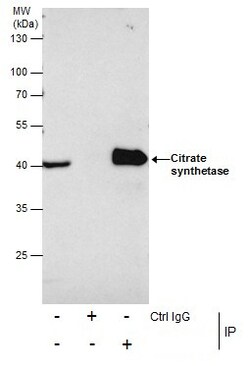 Invitrogen Citrate Synthase Polyclonal Antibody 100 &mu;L | Buy Online | Invitrogen&trade; | Fisher Scientific