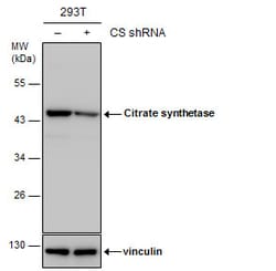 Invitrogen Citrate Synthase Polyclonal Antibody 100 &mu;L | Buy Online | Invitrogen&trade; | Fisher Scientific