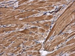 Invitrogen Citrate Synthase Polyclonal Antibody 100 &mu;L | Buy Online | Invitrogen&trade; | Fisher Scientific