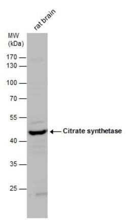 Invitrogen Citrate Synthase Polyclonal Antibody 100 &mu;L | Buy Online | Invitrogen&trade; | Fisher Scientific