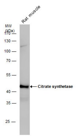 Invitrogen Citrate Synthase Polyclonal Antibody 100 &mu;L | Buy Online | Invitrogen&trade; | Fisher Scientific