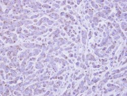 Invitrogen RAB6A Polyclonal Antibody 100 &mu;L; Unconjugated:Antibodies,