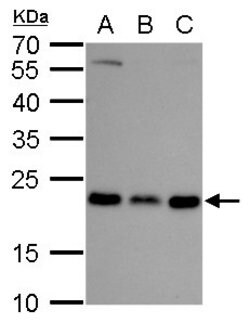 Invitrogen RAB6A Polyclonal Antibody 100 &mu;L; Unconjugated:Antibodies,