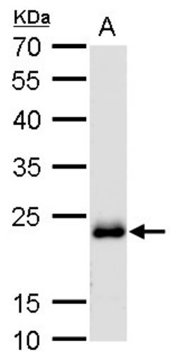 Invitrogen RAB6A Polyclonal Antibody 100 &mu;L; Unconjugated:Antibodies,
