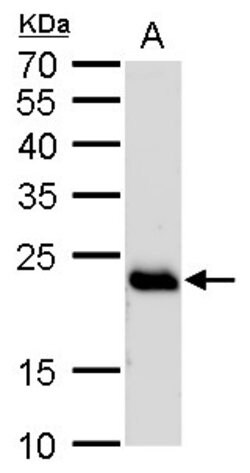 Invitrogen RAB6A Polyclonal Antibody 100 &mu;L; Unconjugated:Antibodies,