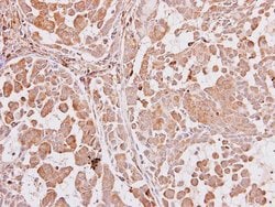 Invitrogen AIP Polyclonal Antibody 100 &mu;L; Unconjugated:Antibodies,