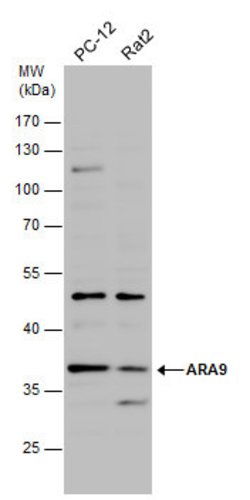 Invitrogen AIP Polyclonal Antibody 100 &mu;L; Unconjugated:Antibodies,