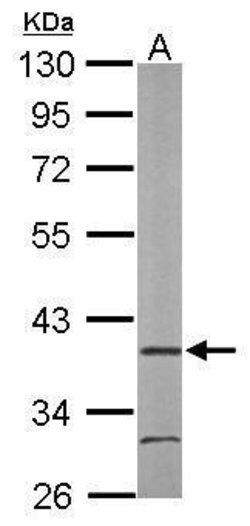 Invitrogen AIP Polyclonal Antibody 100 &mu;L; Unconjugated:Antibodies,