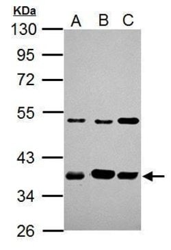 Invitrogen AIP Polyclonal Antibody 100 &mu;L; Unconjugated:Antibodies,