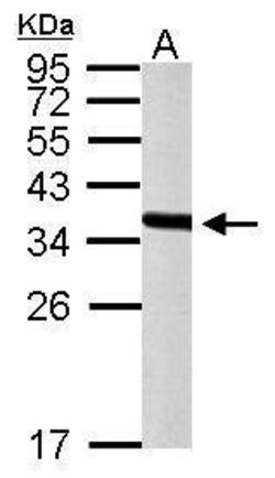 Invitrogen PEX19 Polyclonal Antibody 100 &mu;L; Unconjugated:Antibodies,