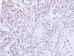 Invitrogen JMJD6 Polyclonal Antibody 100 &mu;L; Unconjugated:Antibodies,