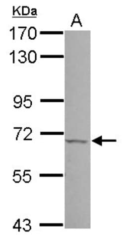 Invitrogen JMJD6 Polyclonal Antibody 100 &mu;L; Unconjugated:Antibodies,