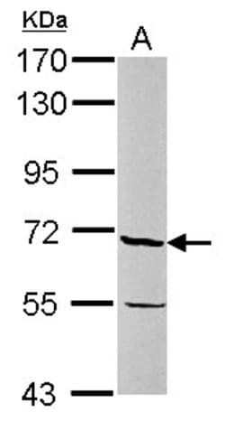 Invitrogen JMJD6 Polyclonal Antibody 100 &mu;L; Unconjugated:Antibodies,