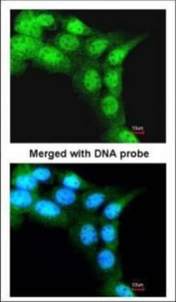 Invitrogen FBXL3 Polyclonal Antibody 100 μL; Unconjugated:Antibodies,