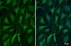Invitrogen ZC3H12A Polyclonal Antibody 100 &mu;L; Unconjugated:Antibodies,
