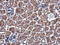 Invitrogen ZC3H12A Polyclonal Antibody 100 &mu;L; Unconjugated:Antibodies,