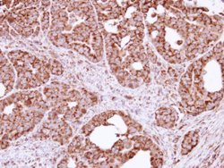 Invitrogen FIS1 Polyclonal Antibody 100 μL; Unconjugated:Antibodies,