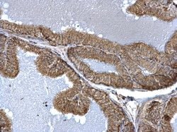 Invitrogen FIS1 Polyclonal Antibody 100 μL; Unconjugated:Antibodies,