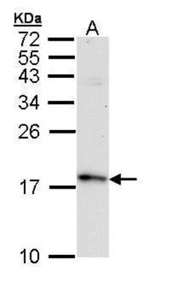 Invitrogen FIS1 Polyclonal Antibody 100 μL; Unconjugated:Antibodies,