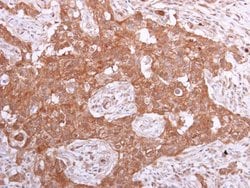 Invitrogen PPA1 Polyclonal Antibody 100 &mu;L; Unconjugated:Antibodies,