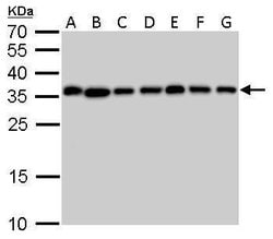 Invitrogen PPA1 Polyclonal Antibody 100 &mu;L; Unconjugated:Antibodies,