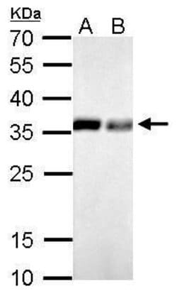 Invitrogen PPA1 Polyclonal Antibody 100 &mu;L; Unconjugated:Antibodies,