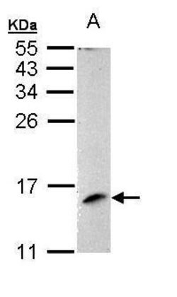Invitrogen LAMTOR3 Polyclonal Antibody 100 &mu;L; Unconjugated:Antibodies,