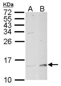 Invitrogen LAMTOR3 Polyclonal Antibody 100 &mu;L; Unconjugated:Antibodies,
